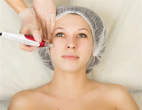 Ultrasonic Face Cleaning Peeling In A Beauty Salon — Stock Photo
