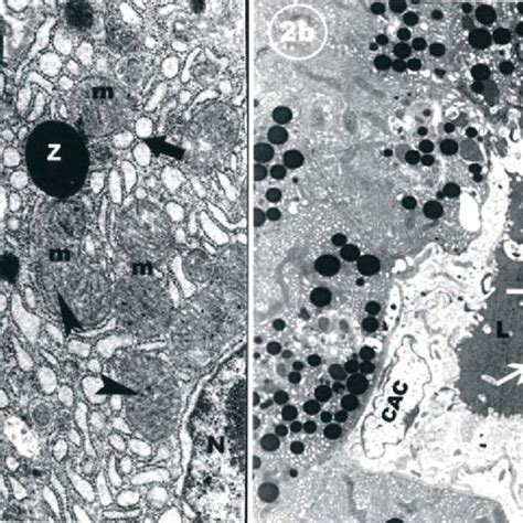 Ultra Structures Of Acinus Cells 2a Nucleus N Zymogene Granules