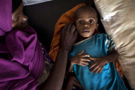 Uma Em Cada Três Crianças Menores De 5 Anos Sofre De Desnutrição Ou Excesso De Peso Mundo SÁbado