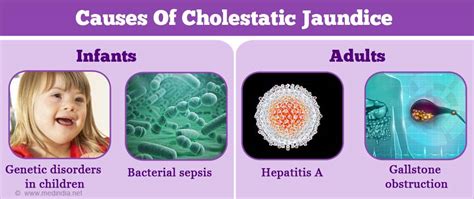 Cholestatic Jaundice - Causes, Symptoms, Risk Factors ...