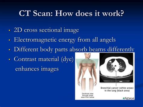 What are the qualifications for unemployment? PPT - Ultrasound PowerPoint Presentation - ID:5961545