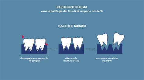 Parodontologia Servizi Centro Odontoiatrico Avanguardia