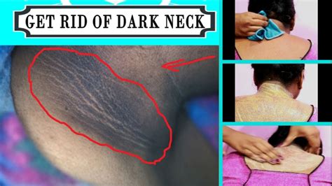 Used to, be used to, get used to. How to Get Rid of Dark Neck Fast and Easy|Natural Remedy ...
