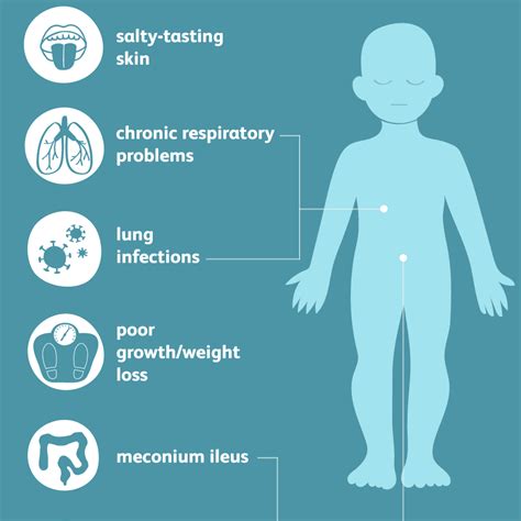 What Are The Signs And Symptoms Of Cystic Fibrosis Cy Vrogue Co