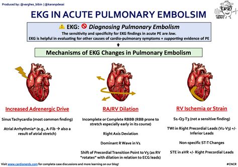 Ekg In Acute Pulmonary Embolism The Sensitivity And Grepmed