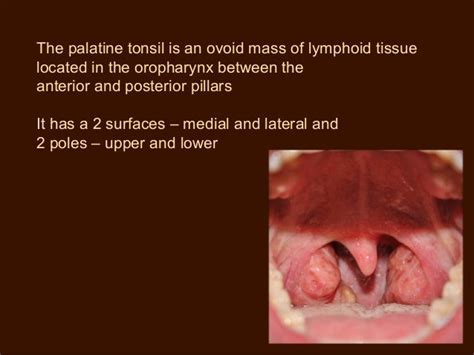 Anatomy Of Tonsils