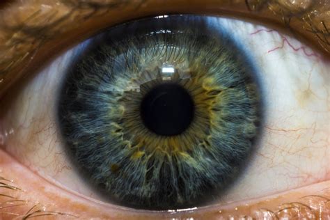 Spots In A Persons Eye Healthfully