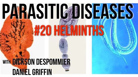 Parasitic Diseases Lectures 20 Helminths Youtube