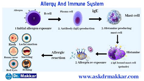 Allergy Allergic Rhinitis Seasonal Allergy Hay Fever Causes