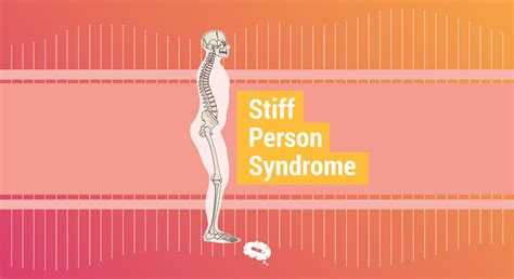 Stiff Person Syndrome Symptoms Causes And Treatment