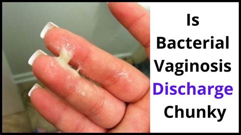 Bacterial Vaginosis Discharge Look Like Here Is It