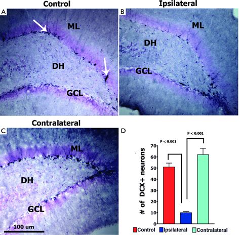 Digital Photomicrographs Of Early Neurogenesis In The Dentate Gyrus As