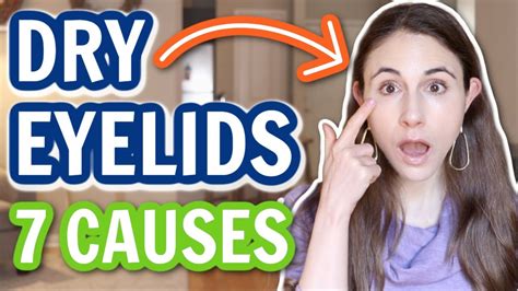 7 Reasons For Dry Eyelids Dermatologist Drdrayzday Youtube