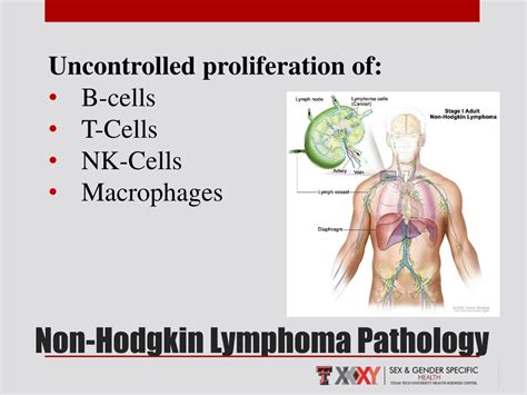 Ppt Lymphoma Powerpoint Presentation Free Download Id8856456