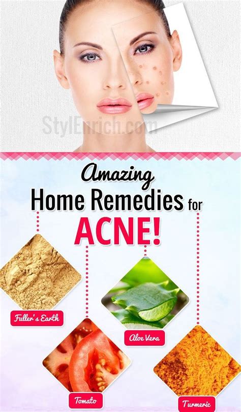 Want To Have A Clear And Blemish Free Skin Learn How To Get Rid Of