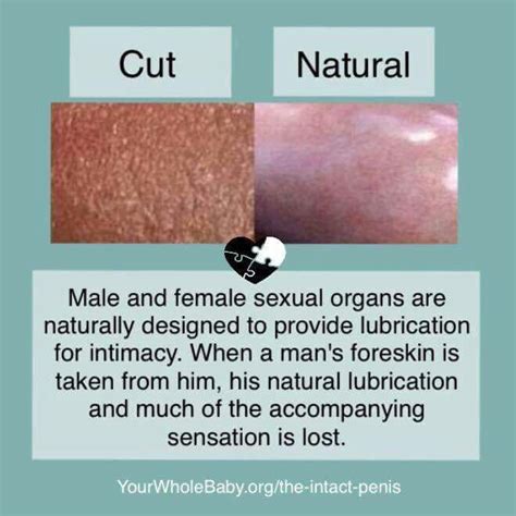 Glans Texture Comparison Of Intact Verses Circumcised Circumcision