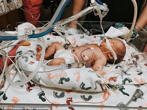 Texas Baby Girl Born With A Hole In Her Heart Celebrates Her First