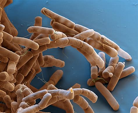 Bacillus Cereus Bacteria Sem Photograph By Meckesottawa Fine Art America