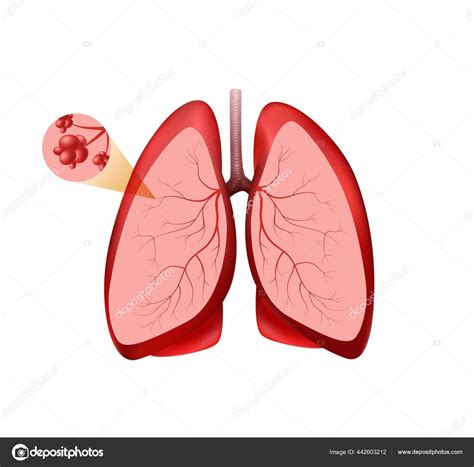 Lokasi pemotongan alveoli pulmoner. Paru-paru merah dengan pembuluh