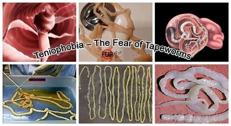 Taeniophobia Teniophobia Fear Of Tapeworms