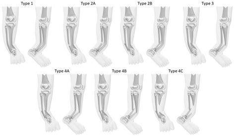 Jcm Free Full Text Reconstructive Approaches In Surgical Management