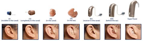 Common Types And Styles Of Hearing Aids Perfect Hearing