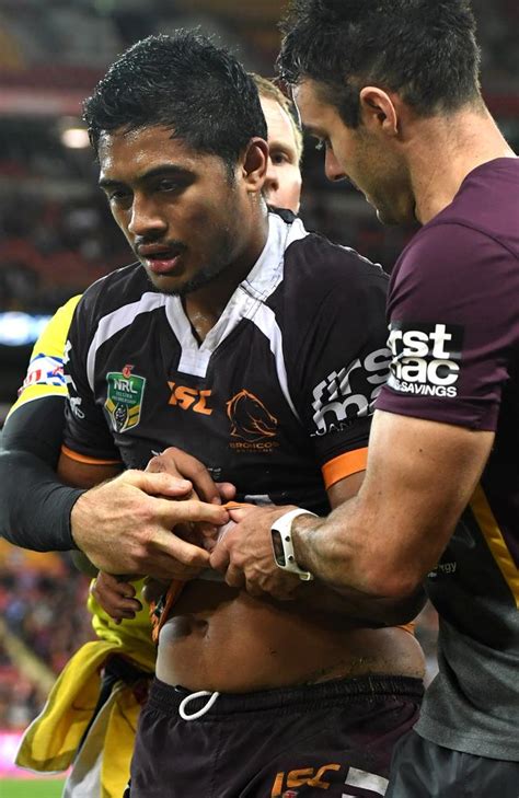 Anthony Milford Requires Surgery After Dislocating His Shoulder Daily