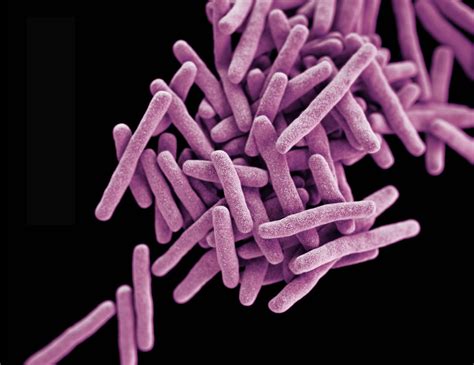 Tuberculosis Bacteria Thrive On A Nitrogen Source Buffet Elife