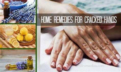 23 Natural Home Remedies For Arthritis In Hands