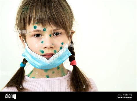 niña que lleva una máscara médica protectora azul enferma de varicela sarampión o rubéola con