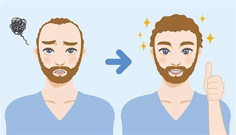 Man With Thinning Hair Illustrations Royalty Free Vector Graphics And Clip Art Istock