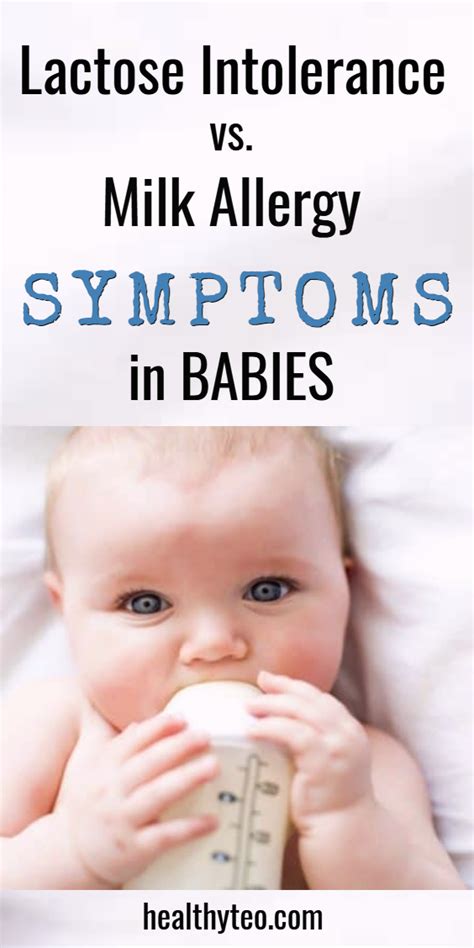Milk Allergy In Babies Symptoms