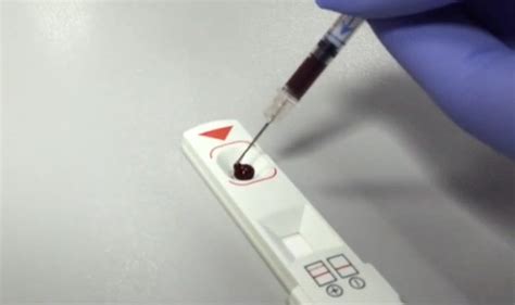 Troponins are protein molecules that are part of cardiac and skeletal muscle. Troponin Normal Range, Causes of Elevated Levels