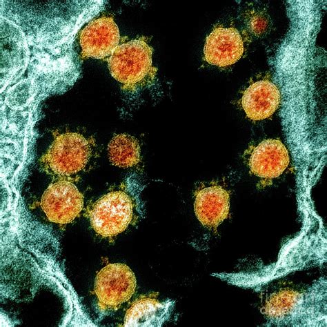 Covid Coronavirus Particles Photograph By Niaid National Institutes
