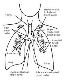Wear protective gear if you work with substances or. How Do You Know If You Have Lung Cancer