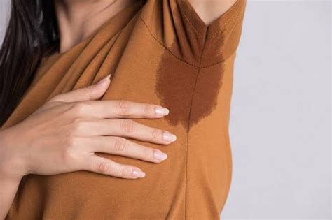 6 Home Remedies To Manage Sweaty Armpits