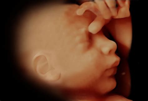 En este caso, la medicina moderna se encarga de que pueda seguir creciendo y desarrollándose fuera del útero. 26 semanas de embarazo - ¡A ponerse guapa! | Maternidadfacil