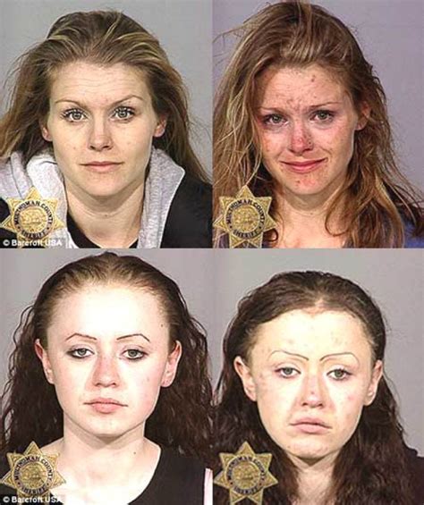 Shocking Before And After Photos Show How Drug Addiction Takes Devastating Toll On Faces Of