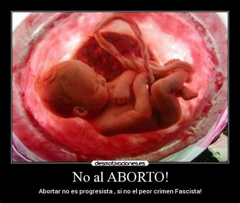 Sintético 105 Foto Aborto Espontaneo Perdida De Un Bebe En Gestacion