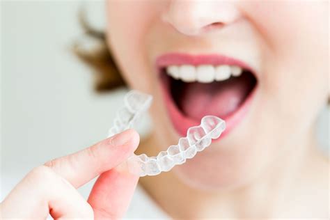 Invisalign Cost Effectiveness And Everything Else You Need To Know