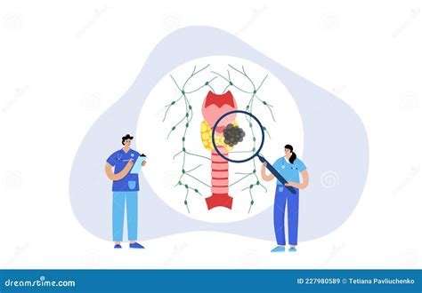 Thyroid Cancer Stages Stock Vector Illustration Of Medical 227980589