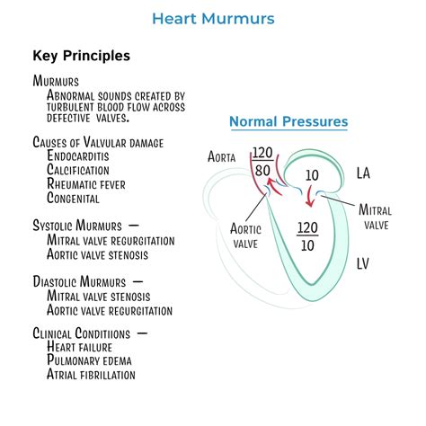 Heart Murmurs Stenosis And Regurgitation Clinical Pathology