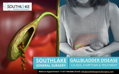 Gallbladder Disease Dr Simone Md Southlake General Surgery