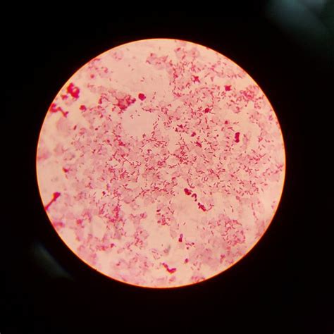 Cocobacilos Gram Negativos Microbiolog A Cosas De Enfermeria