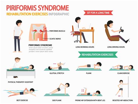 What Is Piriformis Syndrome And What Are The Treatment Options