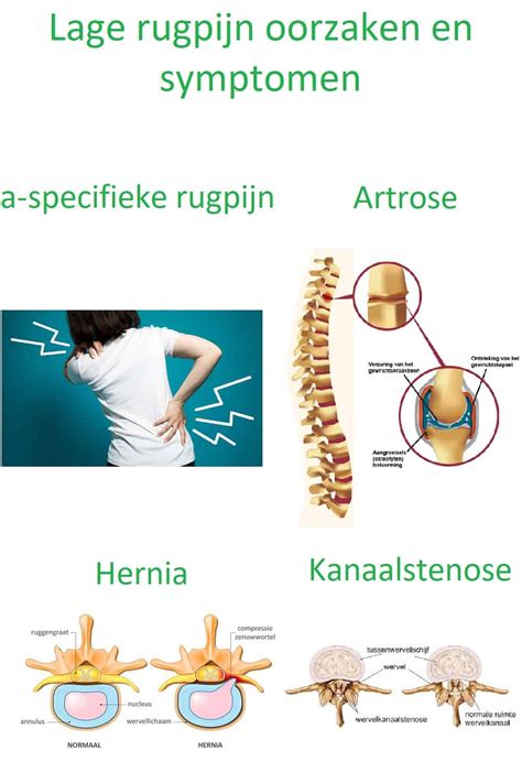 Lage Rugpijn Zelf Verhelpen Met 6 Fysiotherapie Oefeningen