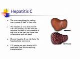 Ayurvedic Treatment For Chronic Hepatitis B