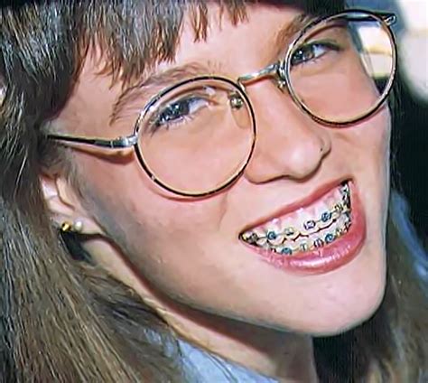 Pin By John Beeson On Girls In Braces Perfect Teeth Glasses Teeth