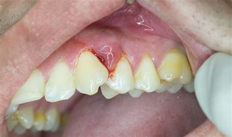 Coronavirus Update Do You Need An Emergency Dentist What To Do During