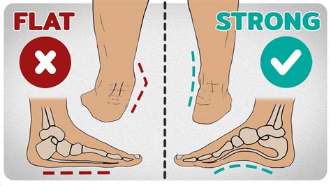 The Arches Of The Foot Longitudinal Transverse Teachmeanatomy